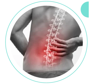 Lombociatalgia | Dr. Allan Garcia - Ortopedista em Brasília