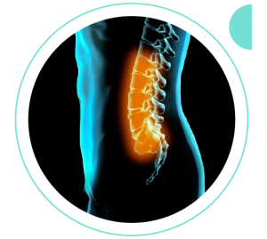 Síndrome da cauda equina | Dr. Allan Garcia - Ortopedista em Brasília